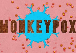 Monkeypox Doubles Up A Public Health Emergency